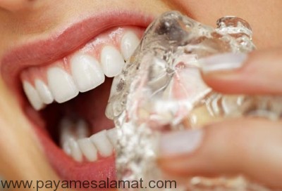 عاداتی که به دندان آسیب می زنند