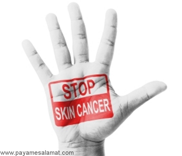 عوامل افزایش دهنده ریسک ابتلا به سرطان پوست