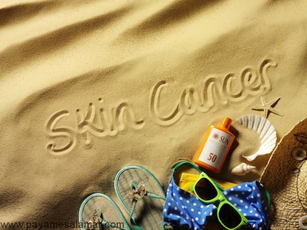 عوامل افزایش دهنده ریسک ابتلا به سرطان پوست