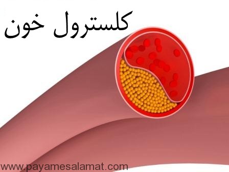 چربی های مفید و مضر برای کلسترول خون