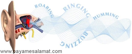 احساس صدای وزوز یا سوت در گوش