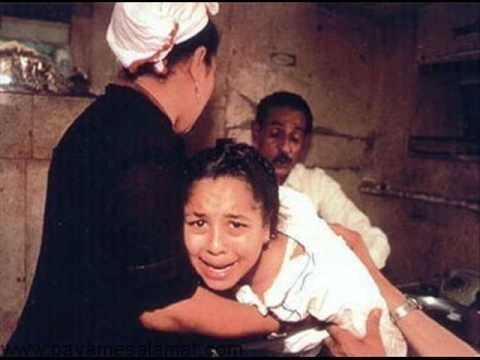 انواع روش های ختنه زنان