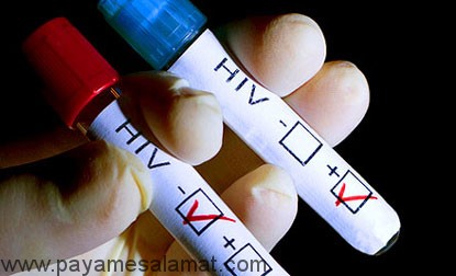 تفاوت بین HIV مثبت و ایدز چیست؟