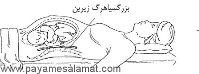 بهترین و بدترین حالت های خواب برای سلامتی شما