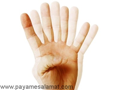 انواع اختلالات بینایی