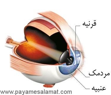 همه چیز درباره پیوند قرنیه چشم