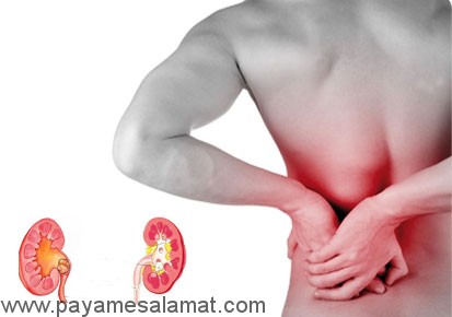 بایدها و نباید های مبتلایان به سنگ کلیه