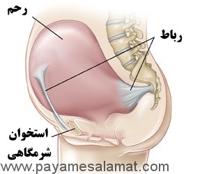 درد رباط گرد در دوران بارداری