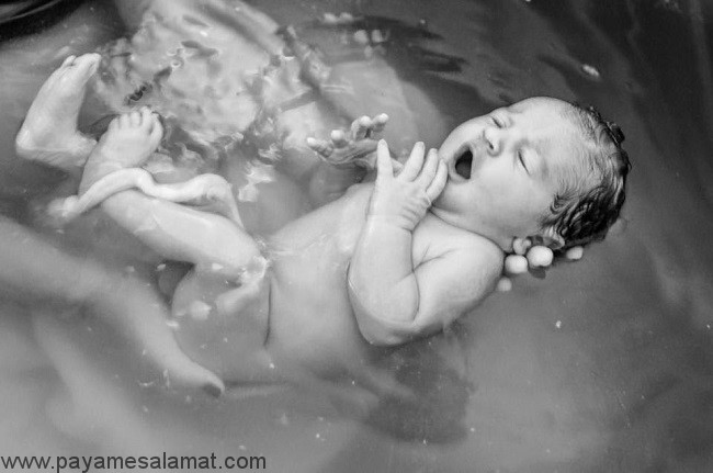 خطرات زایمان طبیعی در آب برای نوزادان چیست؟