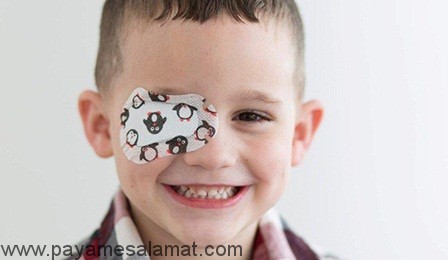 تنبلی چشم (آمبلیوپی) از دلایل ایجاد تا درمان های موثر آن