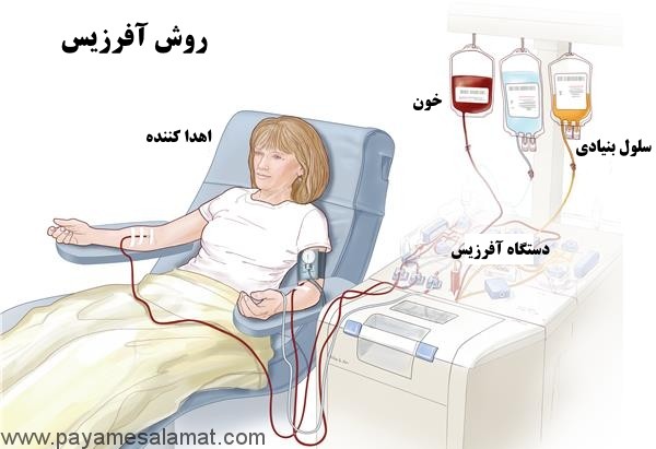 پیوند سلول های بنیادی مغز استخوان و خون، از کاربرد تا روش انجام آن