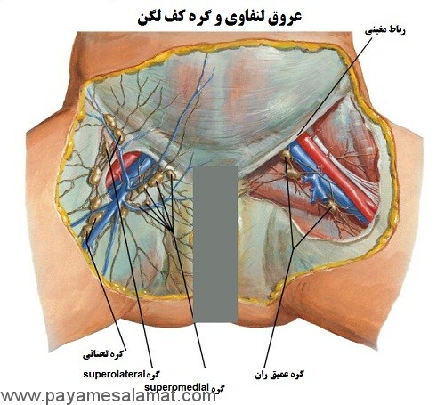 علل بزرگ شدن غدد لنفاوی کشاله ران