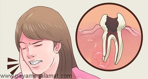سرایت عفونت از دندان به کلیه