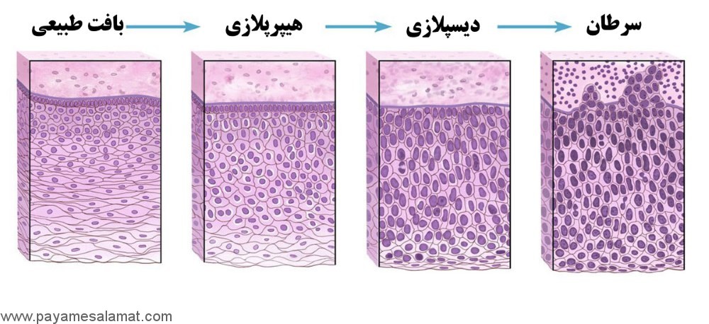 همه چیز در مورد سرطان
