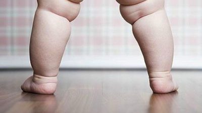 آیا سزارین موجب چاقی کودکان می شود؟