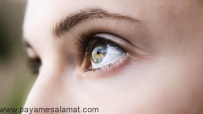 راهکارهای ساده برای درمان پف زیر چشم