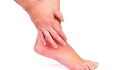 چه چیزی باعث درد مچ پا و التهاب تاندون مچ پا می شود