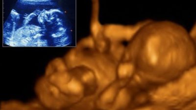 رشد جنین در سه ماهه دوم بارداری