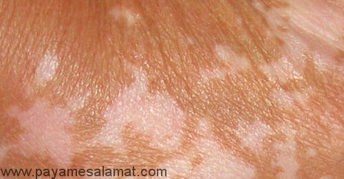 Dog Red And Inflamed Eyes Armpits Dog Red And Inflamed Eyes Armpits