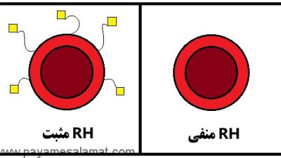 همه آن چه که باید در مورد ناسازگاری RH خون بدانید