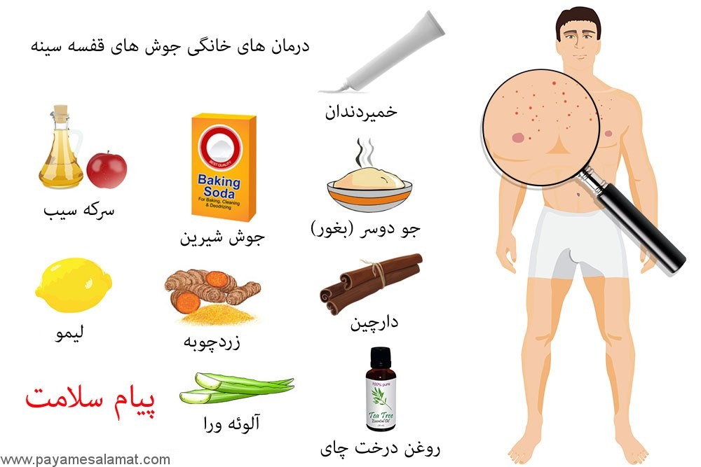 درمان طبیعی جوش های صورت