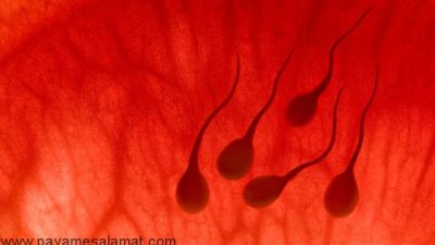 علت وجود خون در اسپرم یا مایع منی یا هماتوسپرمی چیست؟