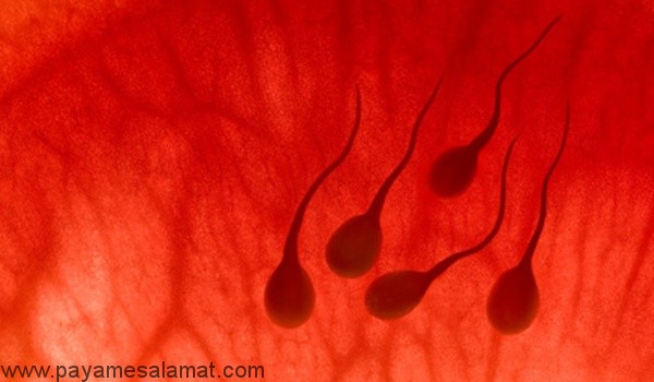 علت وجود خون در اسپرم یا مایع منی یا هماتوسپرمی چیست؟