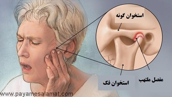 علل درد فک پایین و نشانه های آن