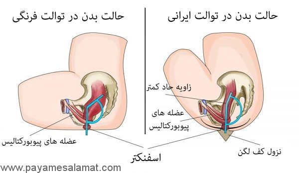 توالت ایرانی بهتر است یا فرنگی؟ چرا