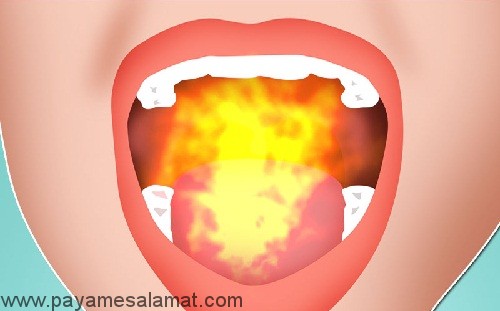 احساس سوزش دهان به چه علت است؟