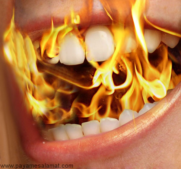 احساس سوزش دهان به چه علت است؟