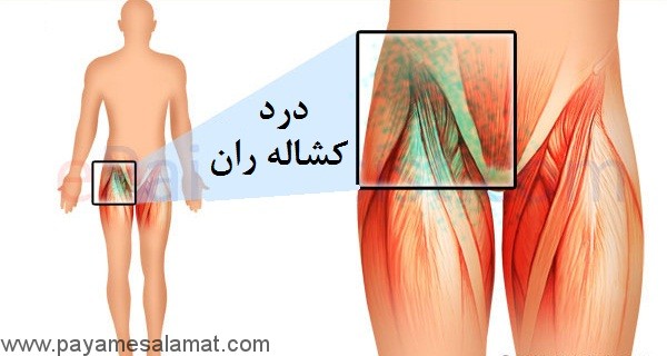 چه چیزی باعث درد کشاله ران می شود و درمان آن چیست؟