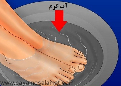 درمان فرو رفتن ناخن پا در گوشت