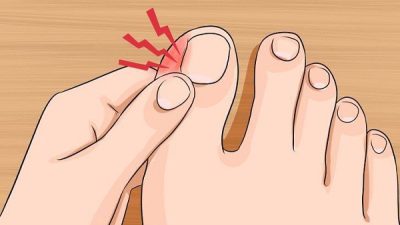 علت درد ناخن پا چیست و چگونه درمان می شود؟