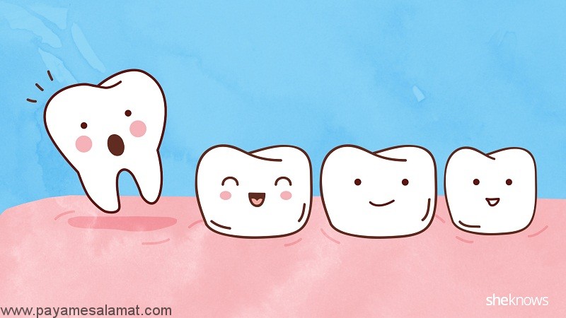علت لق شدن دندان در بزرگسالی چیست؟