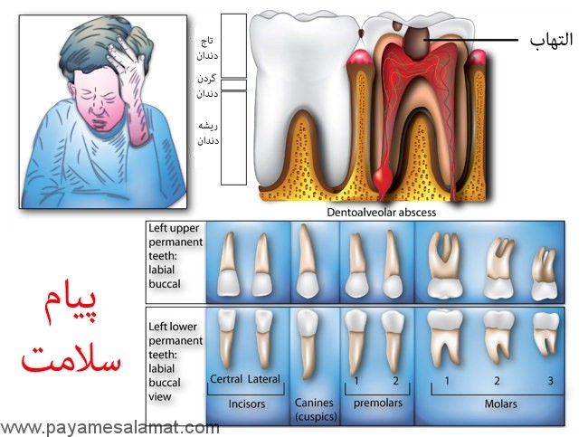 التهاب دندان و دندان درد