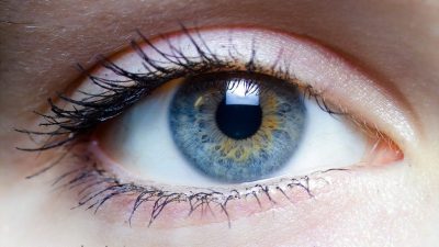 حرکت غیر عادی چشم یا اختلال نیستاگموس