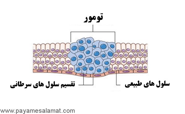 سرطان چیست؟