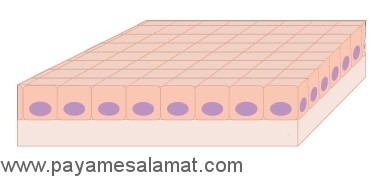 انواع سرطان از نظر سلول های درگیر در بیماری