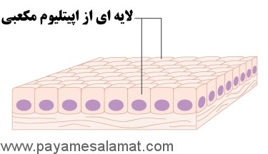 انواع سرطان از نظر سلول های درگیر در بیماری