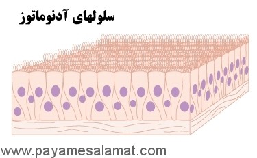 انواع سرطان از نظر سلول های درگیر در بیماری