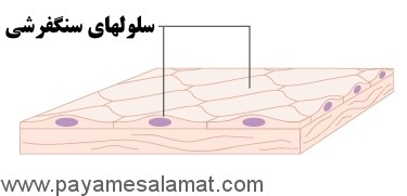 انواع سرطان از نظر سلول های درگیر در بیماری