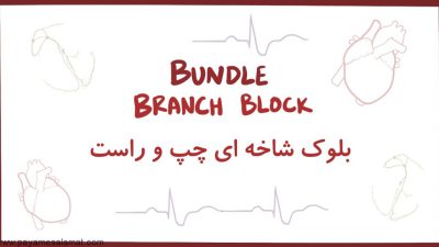 بلوک شاخه ای Bundle Branch Block