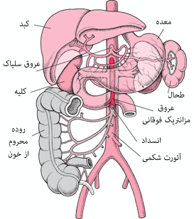 شریان مزانتریک فوقانی