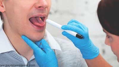 علائم، علل و پیشگیری از لکوپلاکیا (لکه های سفید در دهان و روی زبان)