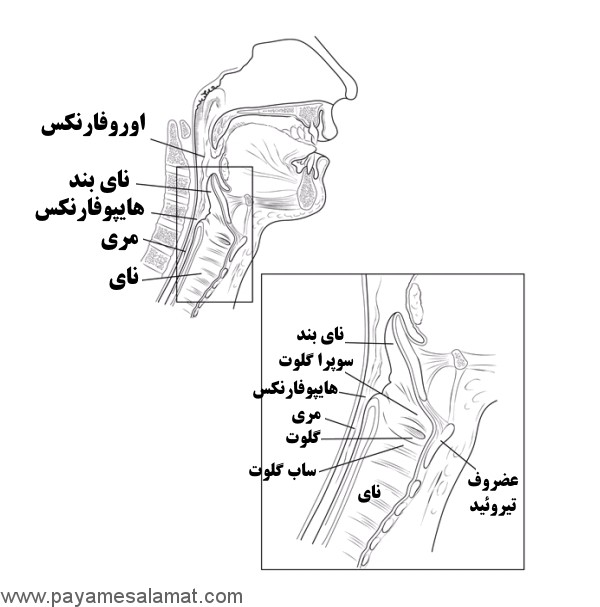 همه آن چه که باید در مورد سرطان حنجره و هیپوفارنکس بدانید