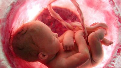 آمبولی مایع آمنیوتیک در دوران بارداری ؛ نشانه ها، علل، عوارض و روش های درمان