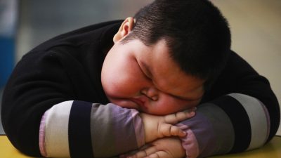 ارتباط چاقی کودکان با بیماری های مفصل ران به خصوص بیماری SCFE