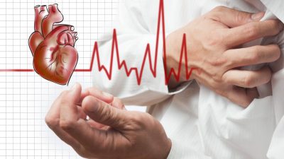 عوارض بیماری عروق کرونر قلب (CAD)