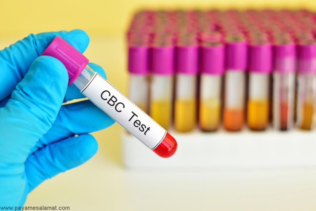 MCH در آزمایش خون به چه معنی است؟